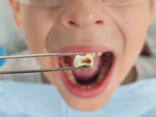 Best Emergency Denture Repair in Bystrom, CA