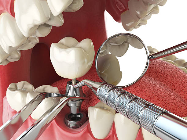 Best Pediatric Emergency Dentist in Bystrom, CA
